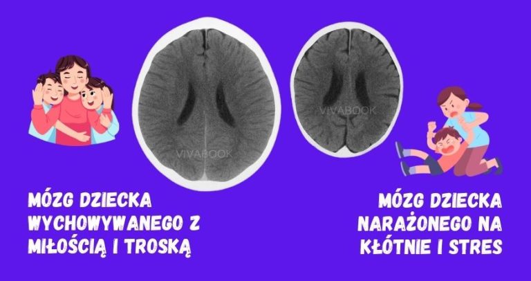 Jak miłość i troska w dzieciństwie kształtują mózg? Oto, co mówi nauka: